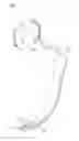Fig. 03 - Caculus removing device