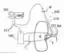 Fig. 01 - Methods and apparatus for monopolar renal neuromodulation