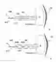 Fig. 07 - Methods and apparatus for monopolar renal neuromodulation