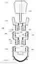 Fig. 02 - Method and system for dental implantation