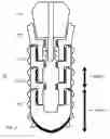 Fig. 03 - Method and system for dental implantation