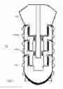 Fig. 04 - Method and system for dental implantation