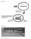 Fig. 02 - Engineered tendon graft for rotator cuff repair