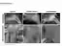 Fig. 03 - Engineered tendon graft for rotator cuff repair