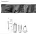 Fig. 05 - Engineered tendon graft for rotator cuff repair