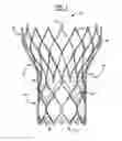 Fig. 02 - Prosthetic Heart Valve with Atraumatic Aortic Portion