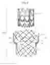 Fig. 09 - Replacement prosthetic heart valves