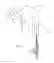Fig. 02 - Method for delivering a prosthetic heart valve