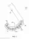 Fig. 05 - Devices and methods for heart valve repair