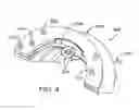 Fig. 06 - Devices and methods for heart valve repair