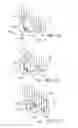Fig. 09 - Devices and methods for heart valve repair