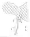 Fig. 19 - Devices and methods for heart valve repair