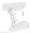 Fig. 20 - Devices and methods for heart valve repair