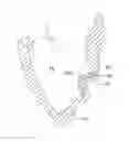 Fig. 01 - Dome structure for improved left ventricle function