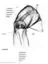 Fig. 03 - System of designing a guide tool and/or surgical kit tools and/or an implant comprising a positioning mark