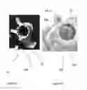 Fig. 05 - System of designing a guide tool and/or surgical kit tools and/or an implant comprising a positioning mark