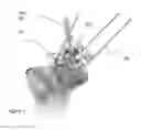 Fig. 08 - System of designing a guide tool and/or surgical kit tools and/or an implant comprising a positioning mark