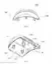 Fig. 04 - Talar ankle implant