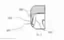 Fig. 06 - Talar ankle implant