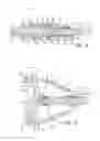 Fig. 17 - Geared cam expandable interbody implant and method of implanting same