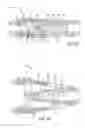 Fig. 27 - Geared cam expandable interbody implant and method of implanting same
