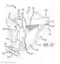Fig. 20 - Geared cam expandable interbody implant and method of implanting same