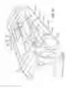 Fig. 30 - Geared cam expandable interbody implant and method of implanting same