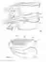 Fig. 04 - INTERVERTEBRAL DISC IMPLANT