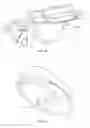Fig. 08 - INTERVERTEBRAL DISC IMPLANT