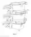 Fig. 10 - INTERVERTEBRAL DISC IMPLANT