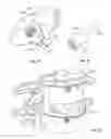 Fig. 15 - INTERVERTEBRAL DISC IMPLANT