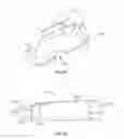 Fig. 33 - INTERVERTEBRAL DISC IMPLANT