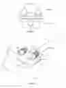 Fig. 46 - INTERVERTEBRAL DISC IMPLANT