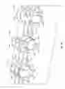 Fig. 56 - INTERVERTEBRAL DISC IMPLANT