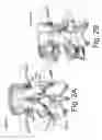 Fig. 03 - Devices and methods for spinal stabilization and instrumentation