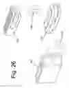 Fig. 30 - Devices and methods for spinal stabilization and instrumentation