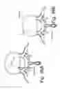 Fig. 40 - Devices and methods for spinal stabilization and instrumentation