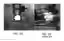 Fig. 02 - Interbody fusion system and methods