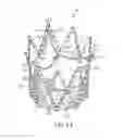 Fig. 14 - Articulated commissure valve stents and methods