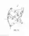 Fig. 18 - Articulated commissure valve stents and methods