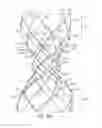 Fig. 30 - Articulated commissure valve stents and methods