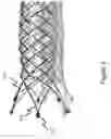 Fig. 04 - Stent and stent connection interface
