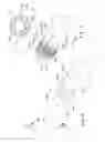 Fig. 09 - Circumferential trigger wire for deploying an endoluminal prosthesis