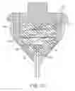 Fig. 04 - Device for intermittently obstructing a gastric opening