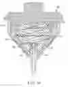 Fig. 06 - Device for intermittently obstructing a gastric opening
