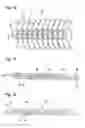 Fig. 06 - Flexible support element for an orthosis