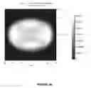 Fig. 17 - Systems and methods for the treatment of eye conditions