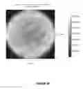 Fig. 18 - Systems and methods for the treatment of eye conditions