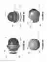 Fig. 20 - Systems and methods for the treatment of eye conditions