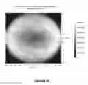 Fig. 22 - Systems and methods for the treatment of eye conditions